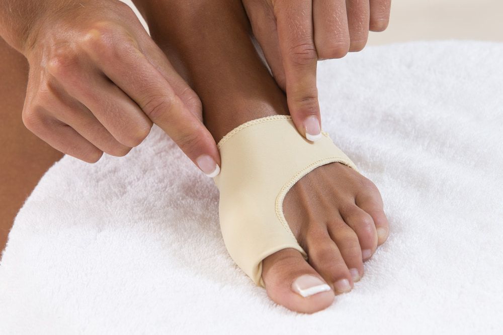 Bunions