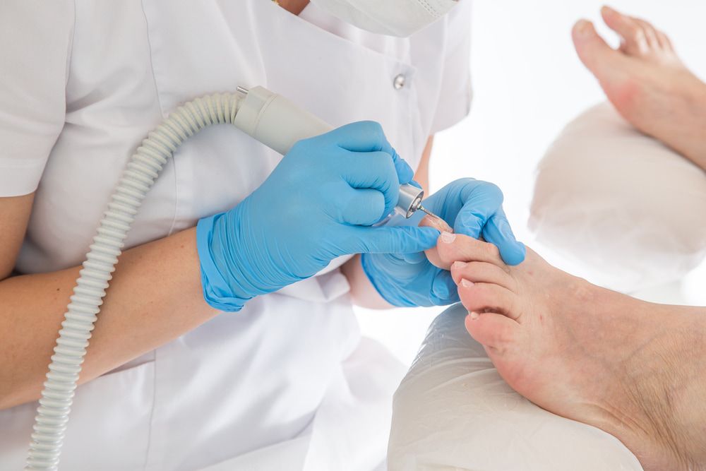 Nail Surgery at Your Local Podiatrist in Katherine