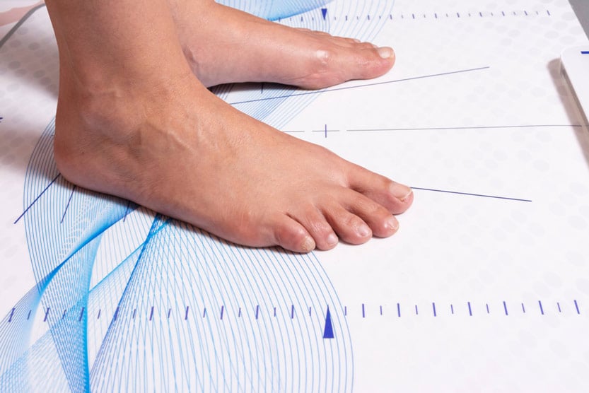 Feet Of A Woman For Biomechanics Assessment